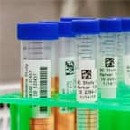 Verschillende testbuisjes met labels worden klaargemaakt voor cryogene opslag.